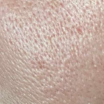 Сыворотка Librederm Seracin 50 мл: отзыв пользователя Детский Мир