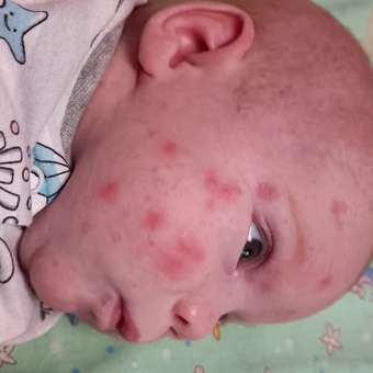Смесь сухая Nutrilon Пепти Аллергия 800г с 0 месяцев: отзыв пользователя Детский Мир