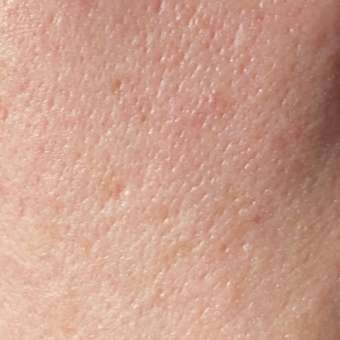 Сыворотка Librederm Seracin 50 мл: отзыв пользователя Детский Мир