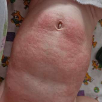 Смесь сухая Nutrilon Пепти Аллергия 800г с 0 месяцев: отзыв пользователя ДетМир